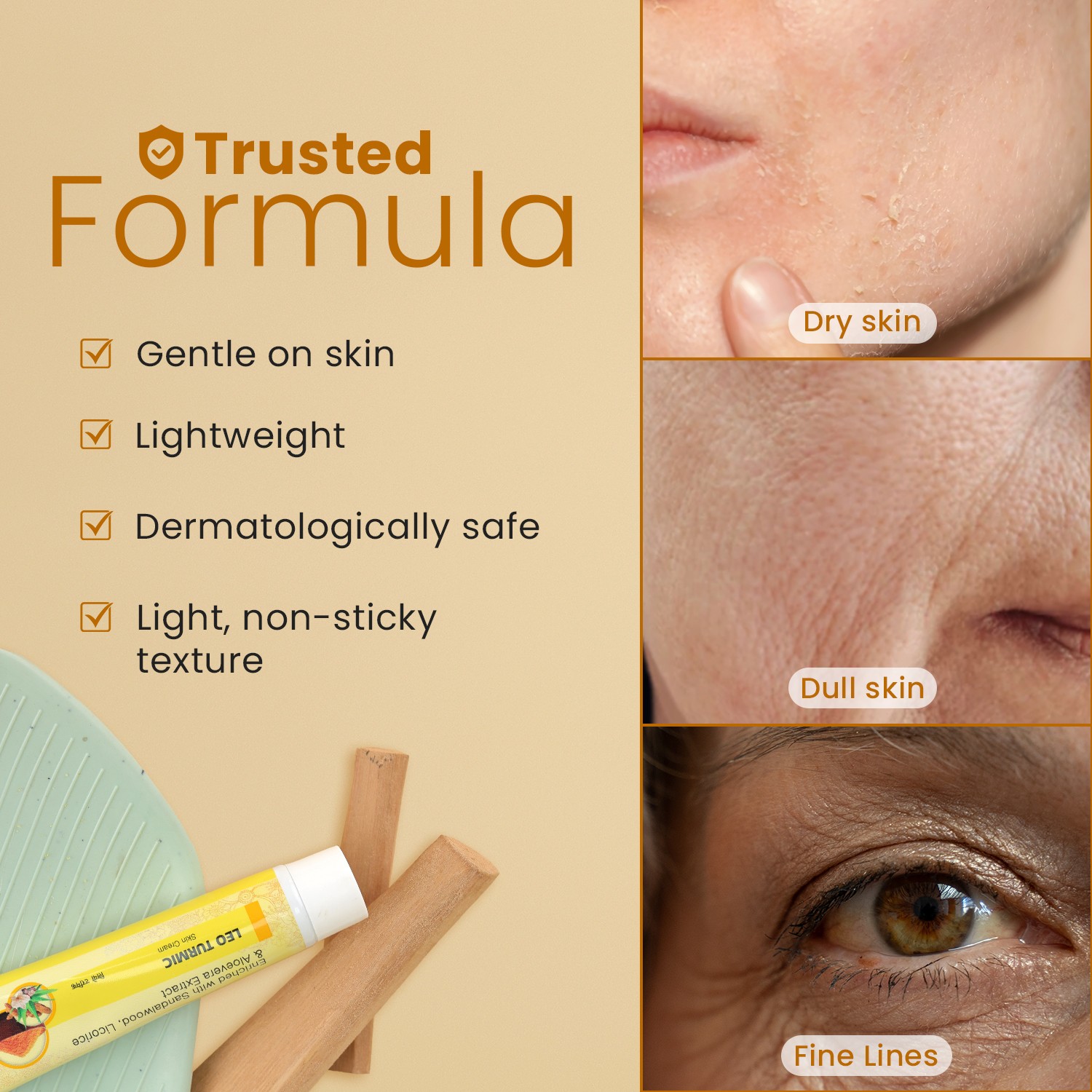 Leo Turmic Skin Cream to treat Acne, Glow & Radiance to your skin, Soft, Smooth & Supple skin, Helps in cuts & burns 30g