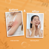 Leseptic Antiseptic Soap for Germ Protection before and after use effects