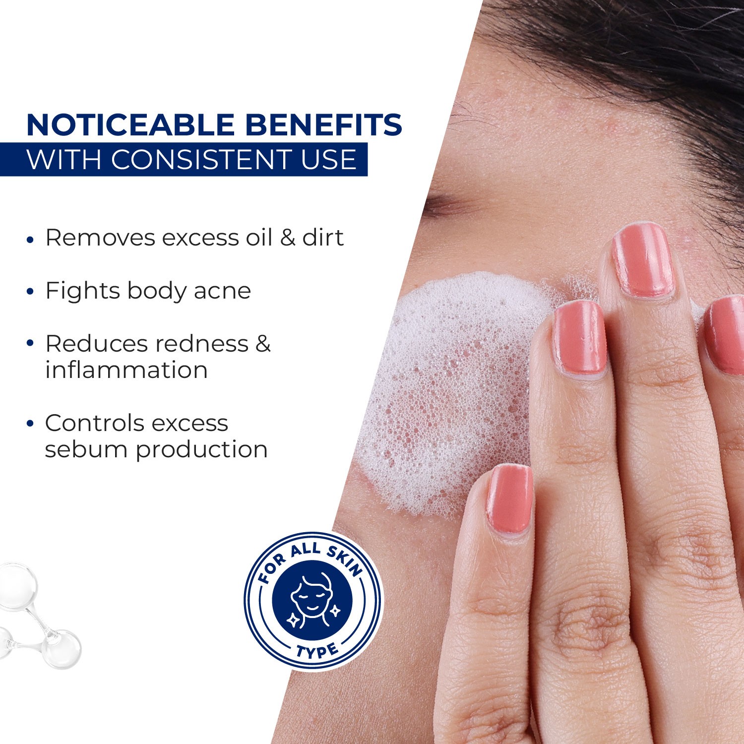 Clinsol Anti-acne Soap for Acne and Pimple Free Skin Benefits