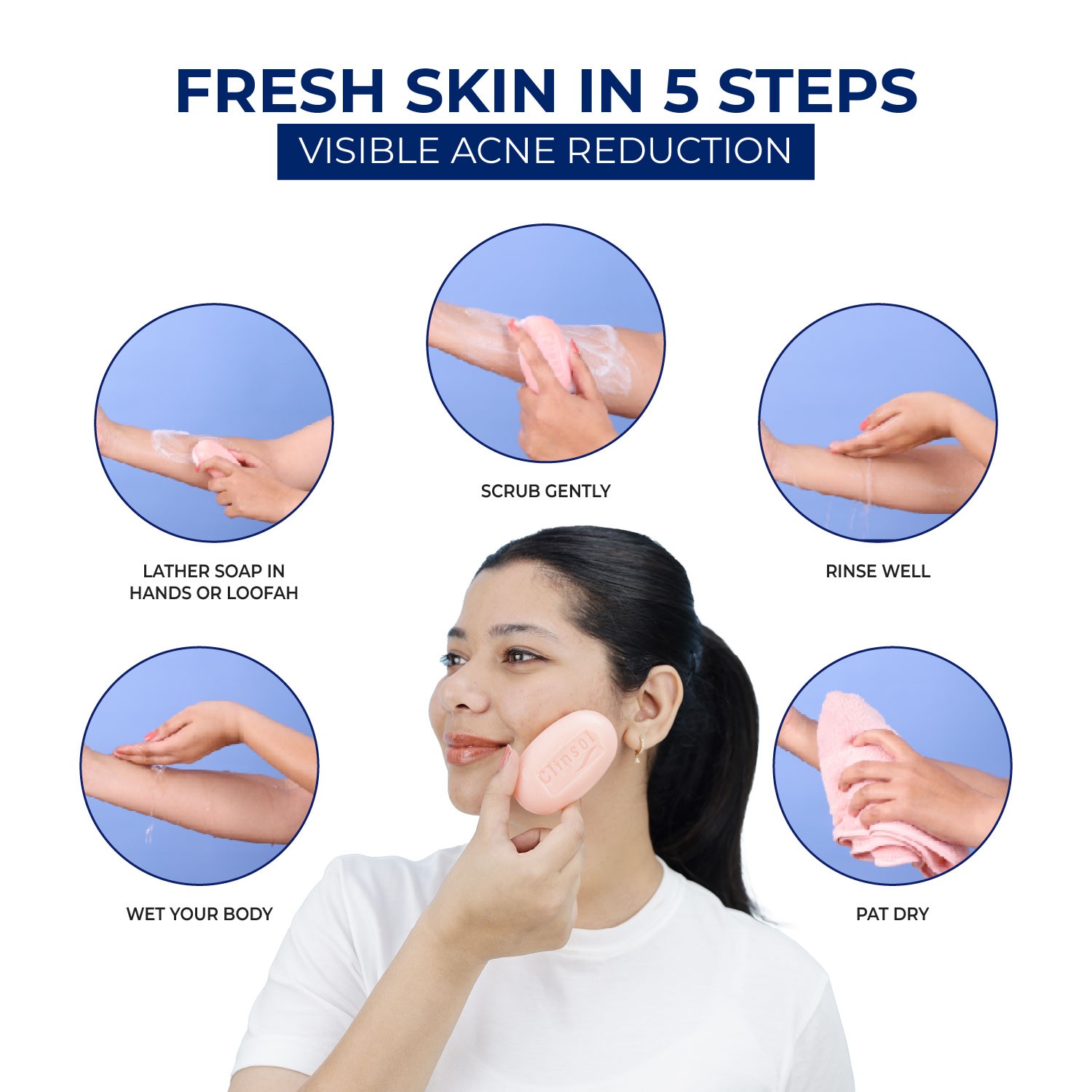 Clinsol Anti-acne Soap for Acne and Pimple Free Skin Fresh Skin In Five Steps