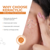 Keracylic Facewash - Active Beads benefits