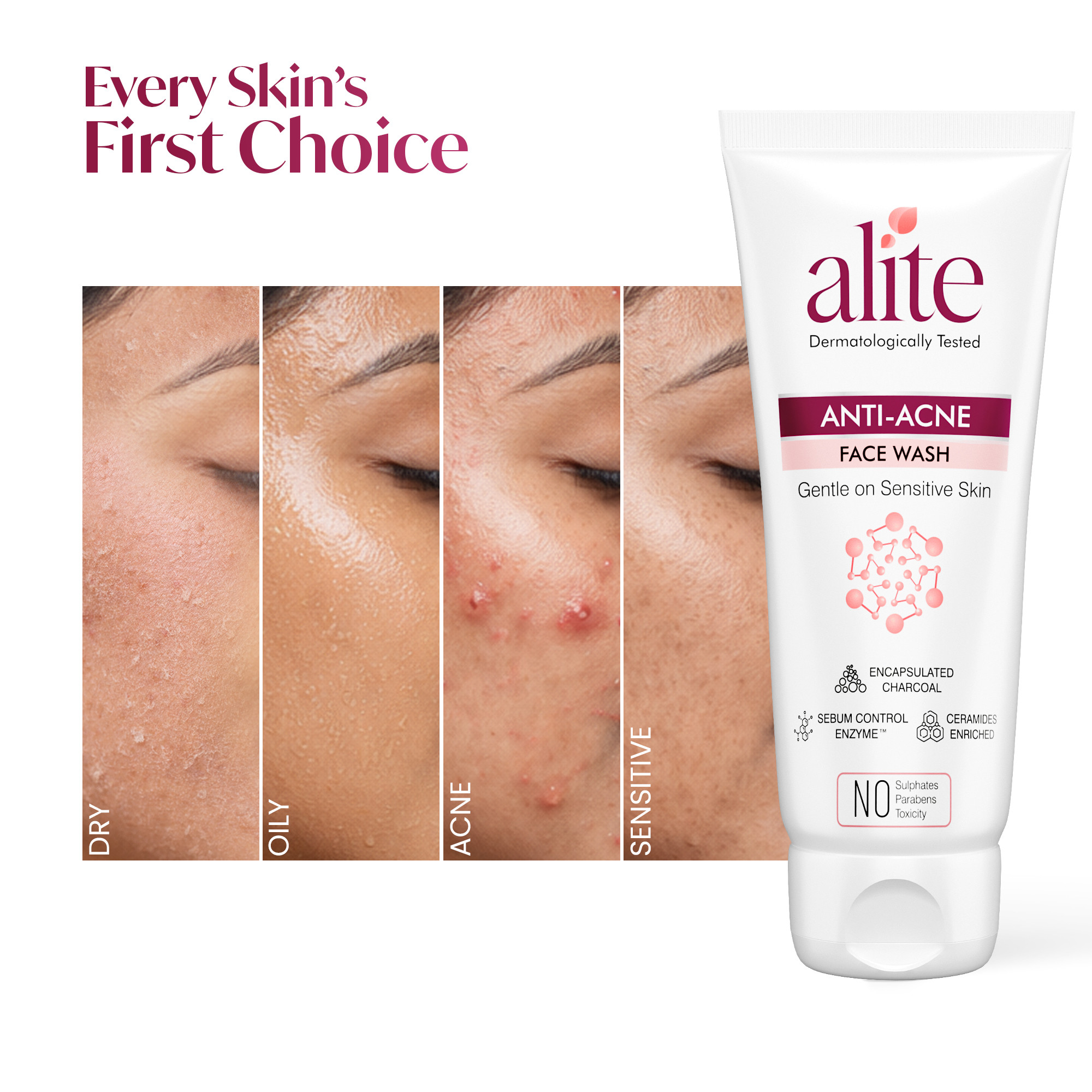 Acnetoin Anti-Acne Facewash 70g - Charcoal Wash for Pimple Relief Skin