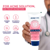 Acnetoin Anti-Acne Facewash 70g - Charcoal Wash for Pimple Relief Skin