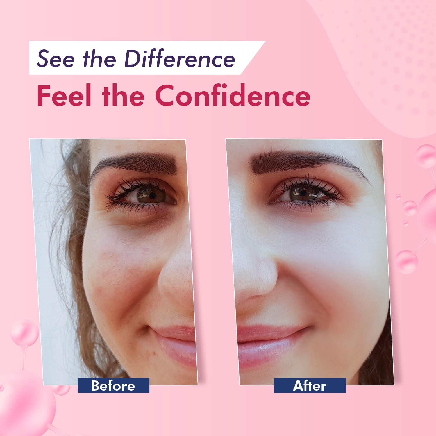 Enshiner Dark Spot Correcting Cream for Men & Women before and after effects