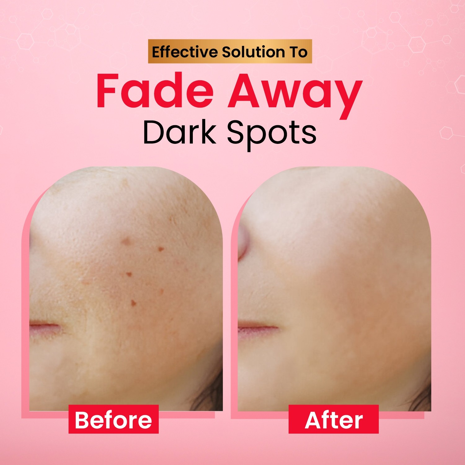 Spotsrub Dark Spot Correcting Cream 15g for Men & Women before and after use