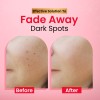 Spotsrub Dark Spot Correcting Cream 15g for Men & Women before and after use