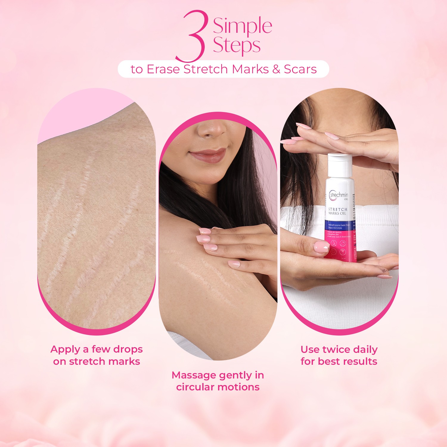 Strechmin Stretch Mark Removal Oil for Women & Men, Pregnancy & Scar Removal use directions