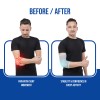elbow binder before and after use comparison