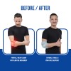 elbow brace before and after use effects