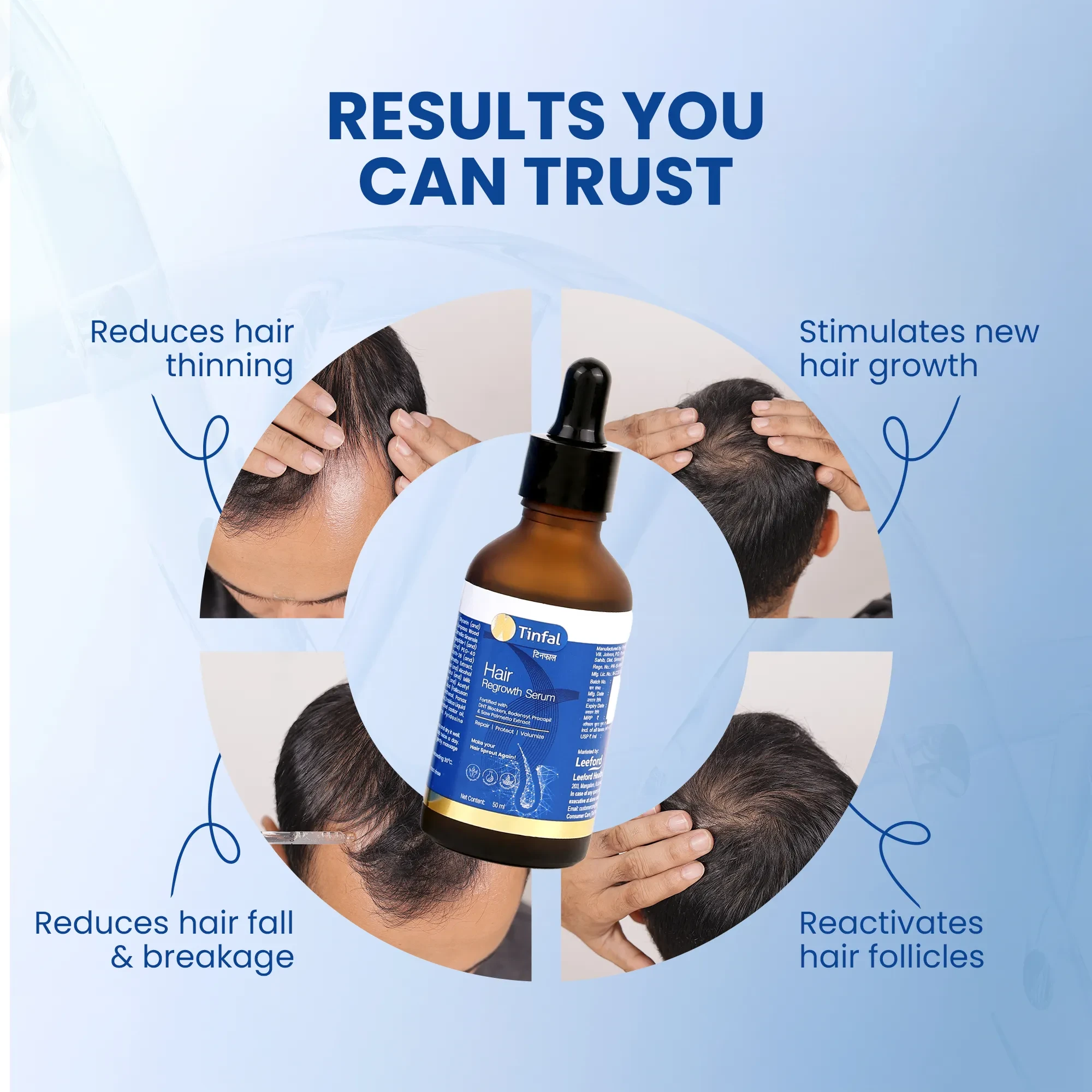 Tinfal Hair Regrowth Serum | 50ml | DHT Blockers to help Repair, Protect & Volumize Hair
