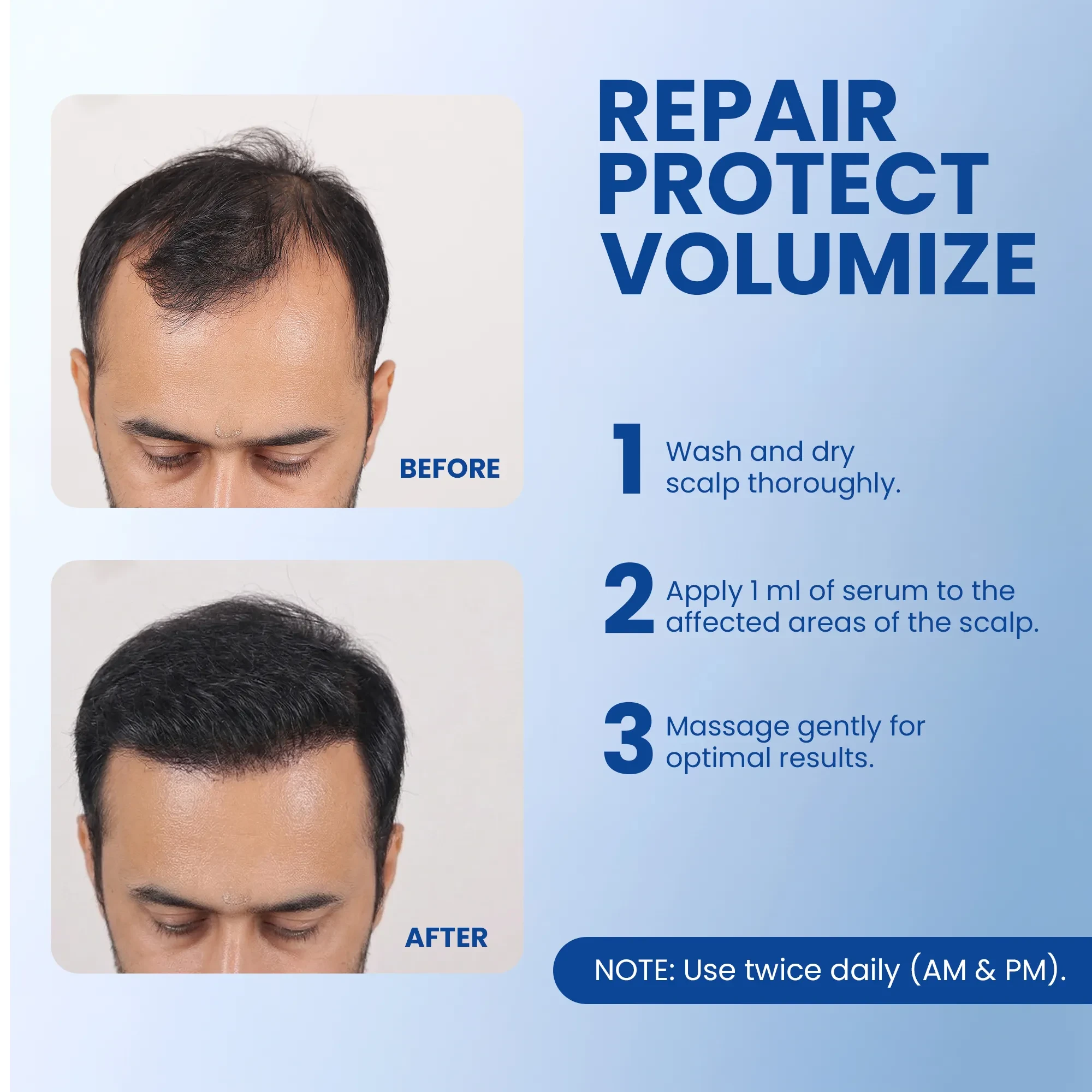 Tinfal Hair Regrowth Serum | 50ml | DHT Blockers to help Repair, Protect & Volumize Hair
