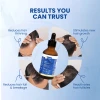 Tinfal Hair Regrowth Serum | 50ml | DHT Blockers to help Repair, Protect & Volumize Hair