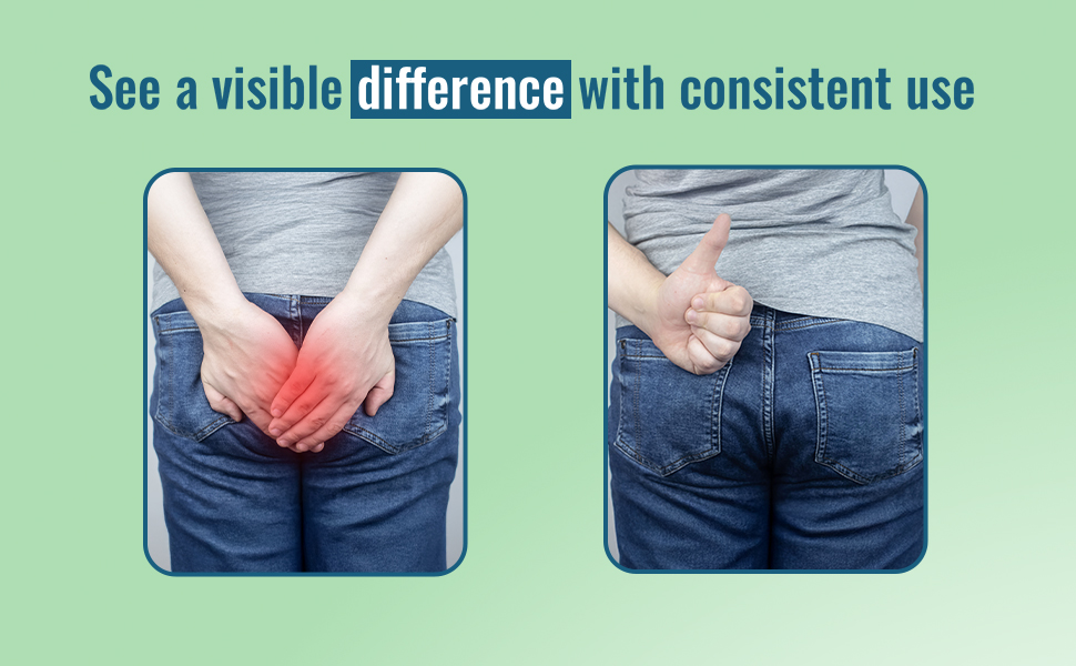 Pilogo ayurvedic cream visible result