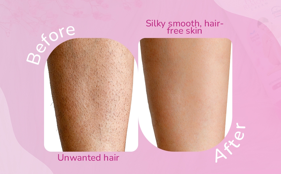 eloway hair removal cream before and after use effects
