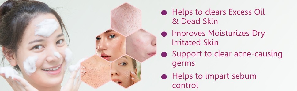 Acnetoin anti acne soap benefits
