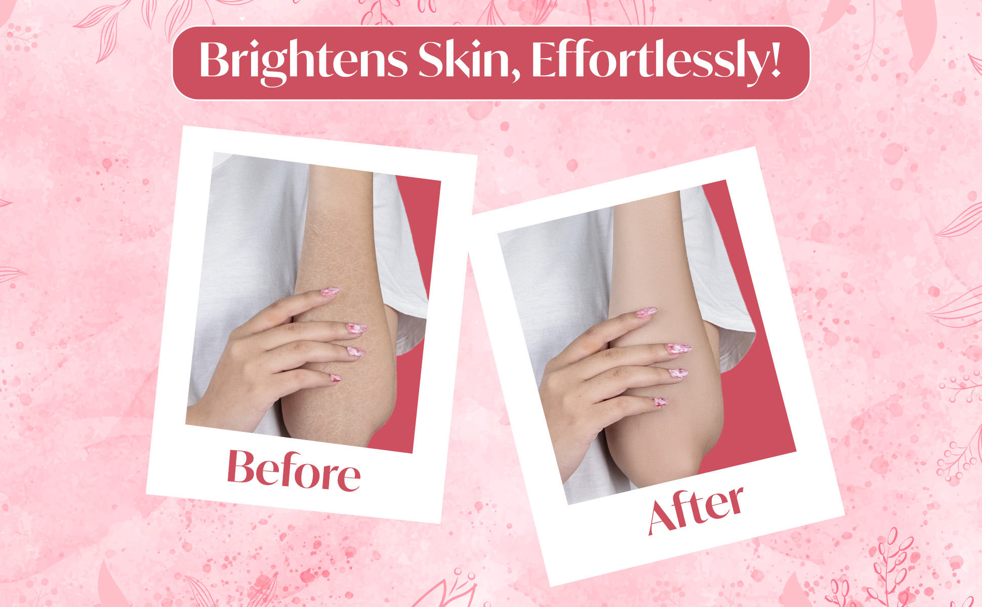 Elosone HT soap before and after skin brightening effects